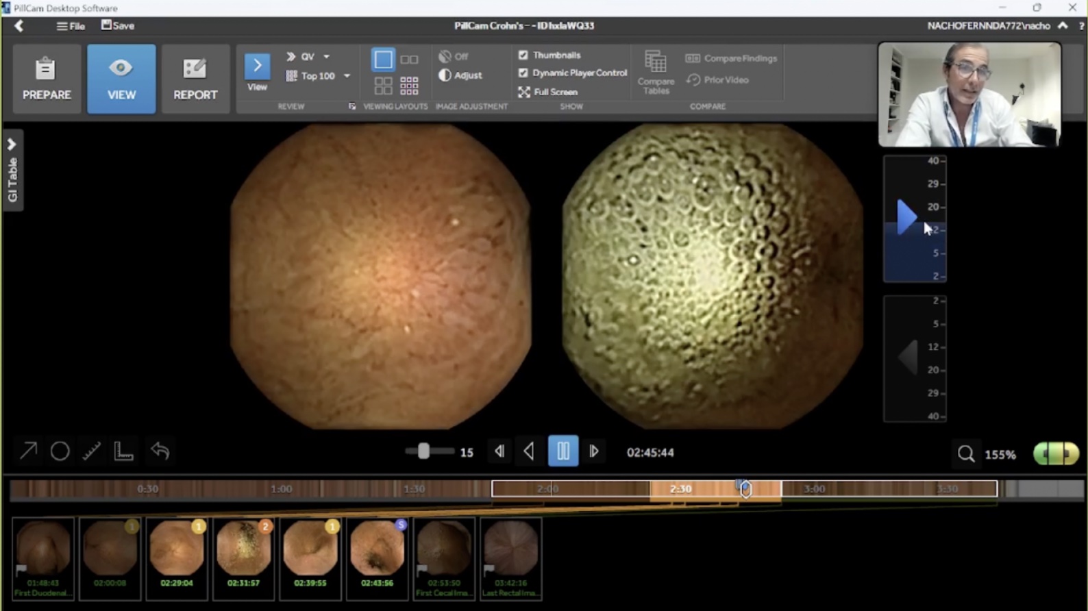 practica guiada curso capacitacion capsula endoscopica- owl eyes academy